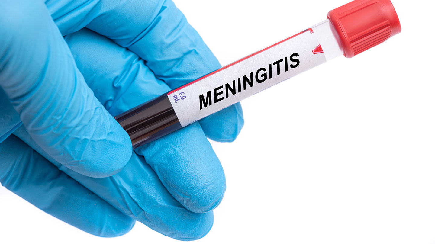 Medizinischer Notfall Meningitis Impfstoff gegen Meningitis